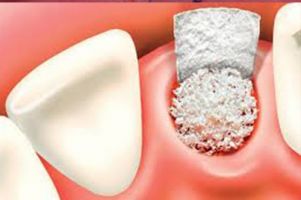 dental implantology courses zurich Dental Campus Association
