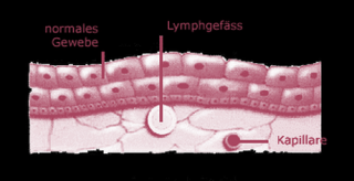 kliniken fur lymphdrainage zurich corpore sano Ruth Frei