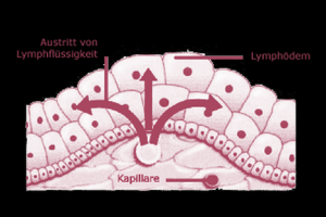 kliniken fur lymphdrainage zurich corpore sano Ruth Frei