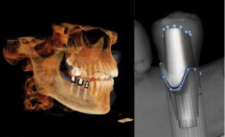 dentistry courses zurich Dental Campus Association